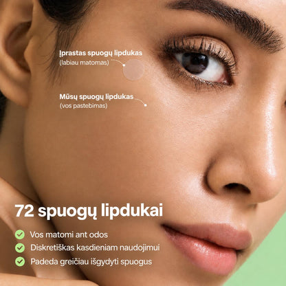 Avore™ spuogų pleistriukai
